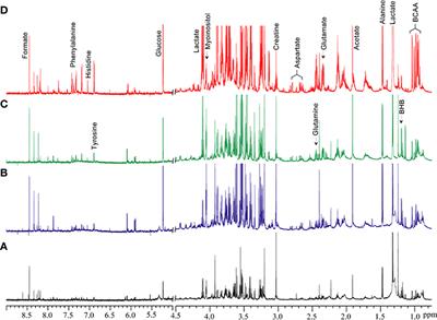 Characterization of lipomatous tumors with high-resolution 1H MRS at 17.6T: Do benign lipomas, atypical lipomatous tumors and liposarcomas have a distinct metabolic signature?